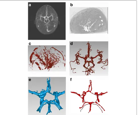 Fig. 5 Pipeline results at different stages. a Maximum intensity project image. b Volume rendering result