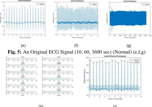 Fig. 5: An Original ECG Signal (10, 60, 3600 sec) (Normal) (e,f,g) 