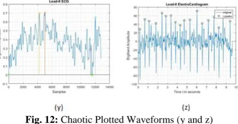 Fig. 10:  Detection of Q Peak, Detection of S Peak, Evaluating the R-R interval and the Heart Rate (s, t, u resp)  