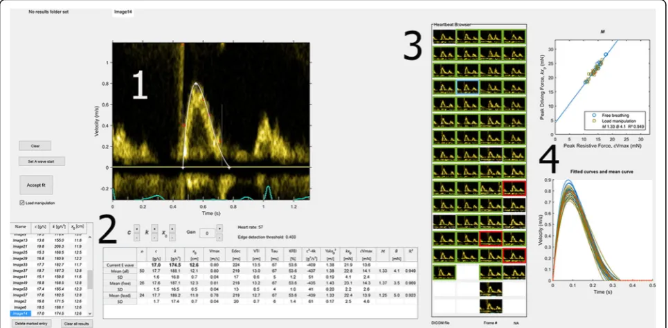 Fig. 1 Overview of the graphical user interface. 1: Display of Doppler data, velocity profile detection and fitted curve for a given heartbeat