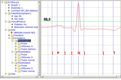 Figure 9Screenshot of ECG viewer