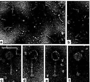 Fig. 8. Phage H23/1, the only phage with rings of small appendages along the whole length of the tail, negatively stained with UA