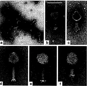 Fig. 1. Phages with usual tail appendages, negatively stained with uranyl acetate (UA}