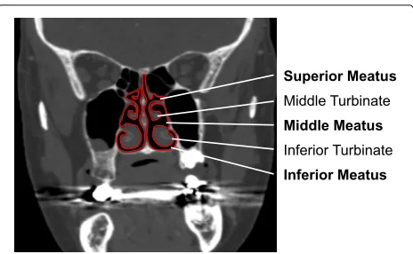 Fig. 2 Fourier descriptor limitations. Here, the right nasal cavitytsection (left side in the image; view from the front) is bounded by aclosed curve, which can be represented parametrically as the periodicfunction p, with two points on p (t = 0.5 and t = 