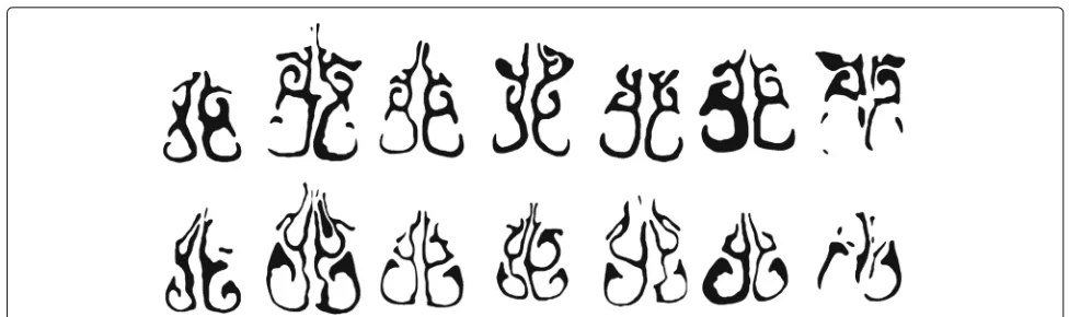 Fig. 8 Variation of nasal cavity shapes. Coronal cross-sections of the nasal cavity.landmark