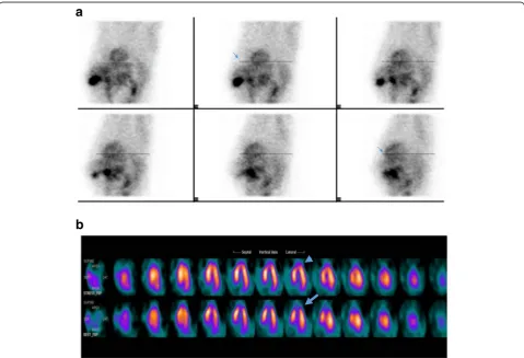 Fig. 2 a From inspection of the raw data (32 planar images) in cinematic display, which were acquired during the “delay phase” of MPI, a downwardpatient movement was detected