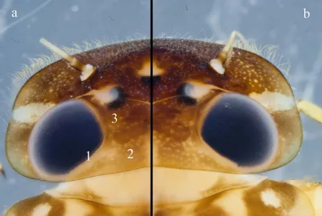 Figure 5. Comparison of z-stacks of setting.  1) The lining of the eye is doubled/spotted