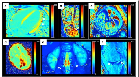 Fig. 4 Application of the proposed T1 and T2 mapping modules on images acquired in humans and ex vivo