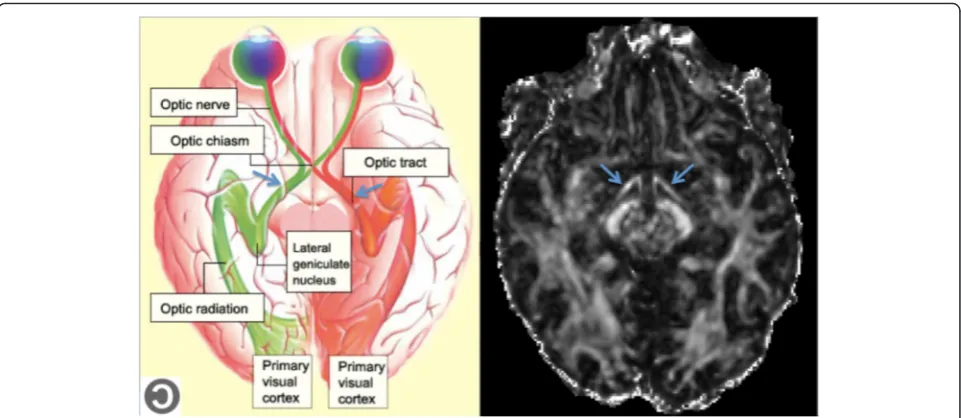 Fig. 1 Left: schematic illustration of the visual pathways in the brain (Copyleft from http://thebrain.mcgill.ca)