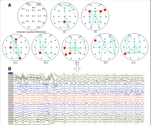 Fig. 2 Construction result of EEG brain network based on mutual information in temporal lobe epilepsy
