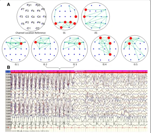 Fig. 3 Construction result of EEG brain network based on mutual information in frontal lobe epilepsy