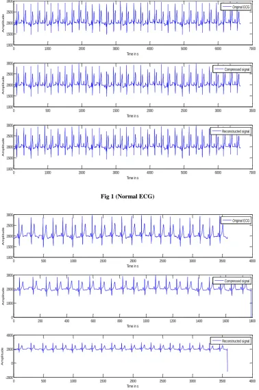 Fig 1 (Normal ECG) 