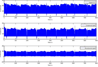 Fig 3 (Arrhythmia ECG ) 