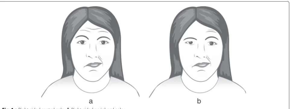 Fig. 1 a Right-sided central palsy. b Right-sided peripheral palsy