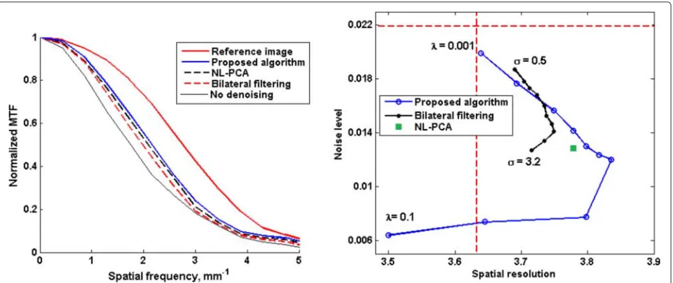 Fig. 7 Performance comparison between different sinogram denoising algorithms on the rat scan