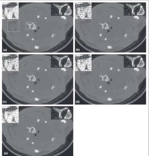 Fig. 8 A slice of the image of the rat reconstructed from noisy and denoised projections:filtering, a the reference image, b without denoising, c bilateral d NL-PCA, and e the proposed algorithm