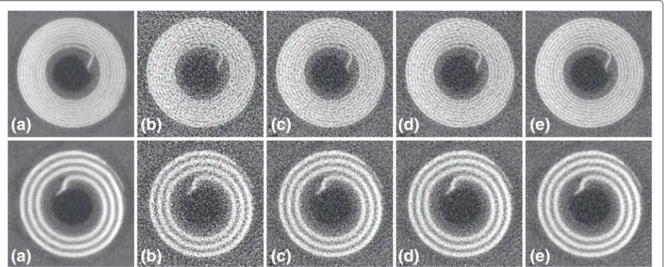 Fig. 4 The 200phantom; − μm (top row) and 500 − μm (bottom row) coils in the images reconstructed from noisy and denoised projections of the physical a the reference image, b without denoising, c bilateral filtering, d NL-PCA, and e the proposed algorithm