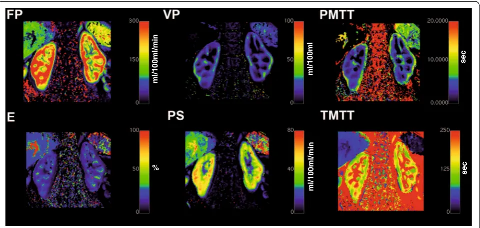 Fig. 8 Parametric maps generated using UMMPerfusion and the 2CFM. Top row from left to right: plasma flow (FP), plasma volume (VP), plasmamean transit time (PMTT)