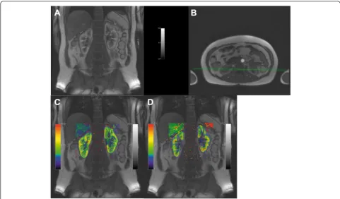 Fig. 9 Example using a data set with different slice orientation and UMMperfusion. a and b two slices from the DCE-MRI acquired following theprotocol described in [57], comprising four coronal slices (a) and one transversal slice (b)