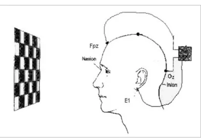 Fig 1: The patient is asked to fix his eye at the centre of the 