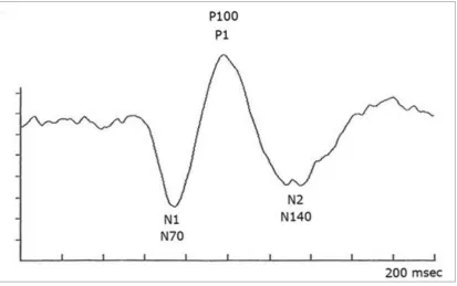FIG 2: The time taken in milliseconds is marked in x-axis and the evoked 