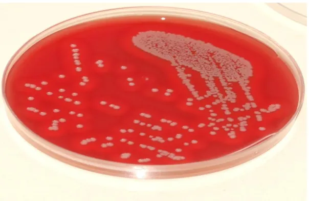 Figure 1: Staphylococcus aureus  - Gram positive cocci in  clusters