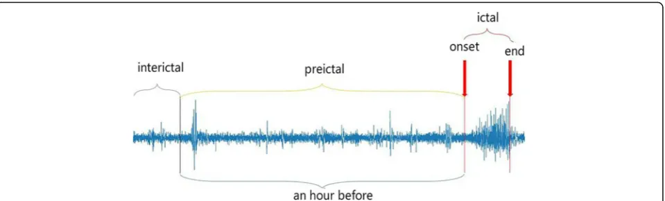 Fig. 1 The single-channel EEG recordings illustrating typical brain states. The typical brain states of epilepsy patients include pre-ictal, ictal and inter-ictal three states
