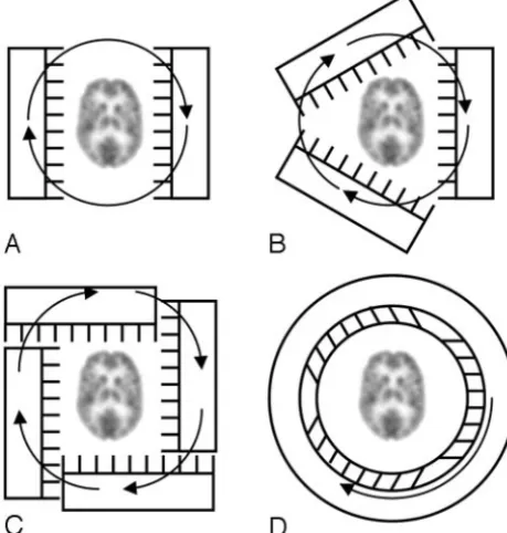 Fig 5. Brain SPECT designs.a factor of 3.that for a single-head camera.the head. A, With a dual-head system, the acquisition time can be half B, With a 3-head system, the acquisition time is reduced by C, Four heads can be offset to allow large-FOV cameras to image close to D, In a ring (helmet) detector, it is possible to rotate only the collimator insidethe crystal and shielding.