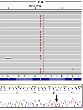 Figure 4.7.8.1 Clustal W multiple sequence alignment: Evolutionary conservation of amino acids in transferrin gene among 14 species