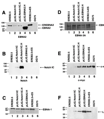 FIG. 8. Detection of EBNAs, LMP-1, and c-Myc in EREB2.5 cells expressing high levels of Notch1IC after estrogen withdrawal