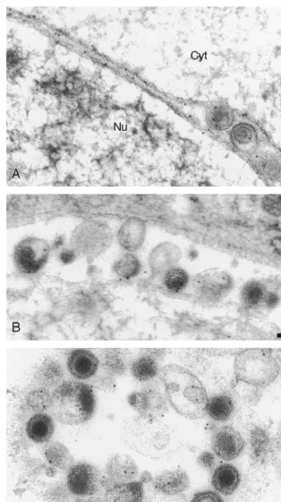 FIG. 1. Immunogold labeling of cells infected with HSV-1 expressing wild-type gD. (A) Decoration of inner and outer nuclear membranes andparticles in the perinuclear space; (B and C) decoration of extracellular particles