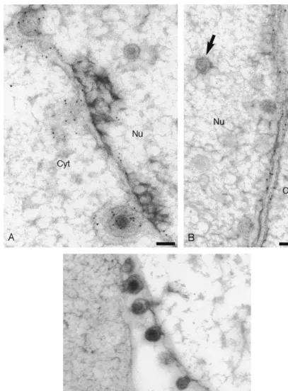 FIG. 2. Immunogold labeling of cells infected with HSV-1 expressing an ER-targeted gD