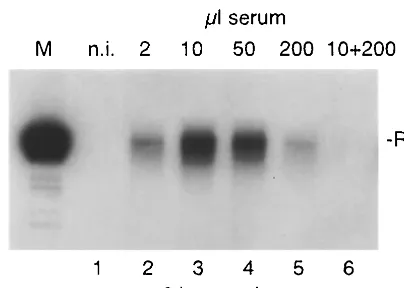 FIG. 1. HBV binding to PTH. Cells were incubated for 6 h withincreasing volumes of HBV DNA-positive serum (lanes 2 to 5) or a
