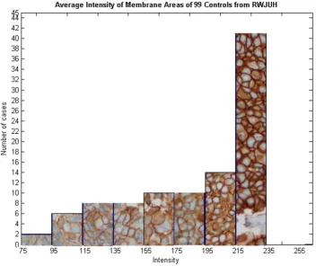 Figure 5Variations on the Membrane Staining Intensities of Positive Control Specimensmost positive controls stain darkly (215–235), there is a significant number of cases in which staining intensity deviates mark-Variations on the Membrane Staining Intensi