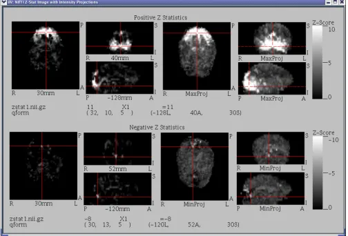 Figure 8This figure contains images generated from a NIfTI Z-Stat sample data file downloaded from the NIfTI web site [22]This figure contains images generated from a NIfTI Z-Stat sample data file downloaded from the NIfTI web site [22]
