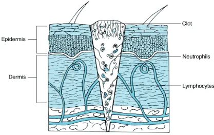 FIGURE 2- STAGE OF INFLAMMATION  