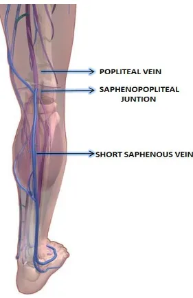 FIGURE 8: SHORT SAPHENOUS VEIN 