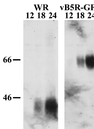 FIG. 2. Synthesis of B5R-GFP. HeLa cells were infected with WRor vB5R-GFP. At various time points, cells were harvested and ana-
