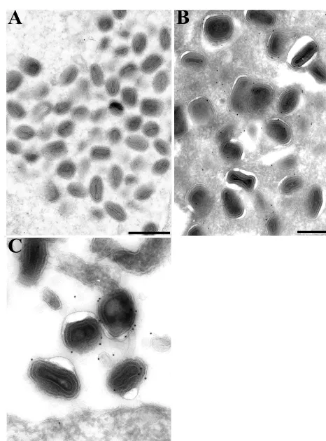 FIG. 4. Immunogold electron microscopy of cells infected with vB5R-GFP. RKﬁxed in paraformaldehyde, cryosectioned, and incubated with GFP polyclonal antibody followed by 10-nm-diameter gold particles conjugated to13 cells that had been infected with vB5R-G