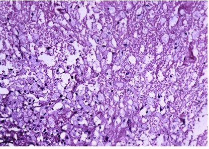 Figure 2. (Hematoxylin-eosin , magnification 20x) Complete 