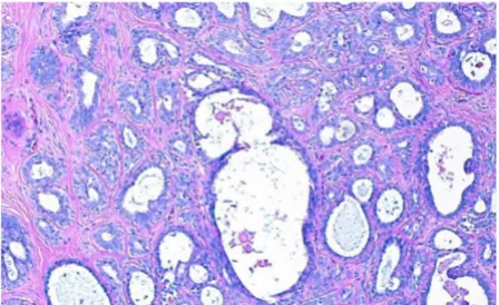 Figure 3Histology image segmentation into chromatin-rich, stromal, and unstained regions using image intensityHistology image segmentation into chromatin-rich, stromal, and unstained regions using image intensity