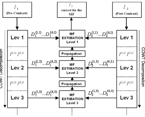 Figure 1Hierarchical algorithm structureHierarchical algorithm structure. CDWT decomposition is applied to the pre-contrast and the post-contrast images