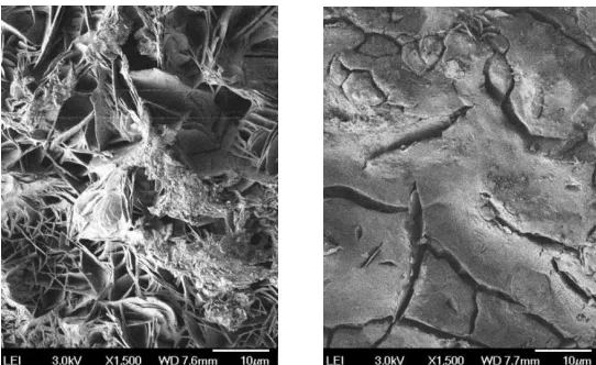 Fig. 8. FESEM Micrograph of Zn Electrodeposits from the Bath with presence of KOH a) Low magnification of submicron particles  b) High magnification of submicron particles 