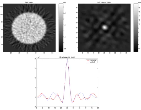 Figure 8Results of PET/CT study on the cylindrical Nema phantomResults of PET/CT study on the cylindrical Nema phantom