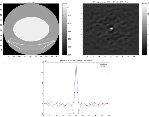 Figure 9Results of PET/CT study on the elliptical Torso phantomResults of PET/CT study on the elliptical Torso phantom
