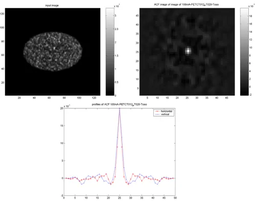 Figure 11Results of PET/CT study on elliptical Torso phantomResults of PET/CT study on elliptical Torso phantom