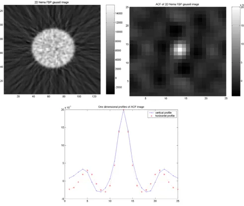 Figure 1Results of the cylindrical NEMA phantom study(FWHM) Gaussian filter, corresponding ACF image (upper right) and vertical (dash point) and horizontal profiles (dash star) Results of the cylindrical NEMA phantom study