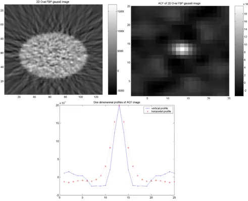 Figure 2Results of the elliptical torso phantom studyfilter, corresponding ACF image (upper right) and vertical (dash point) and horizontal profiles (dash star) through the ACF Results of the elliptical torso phantom study