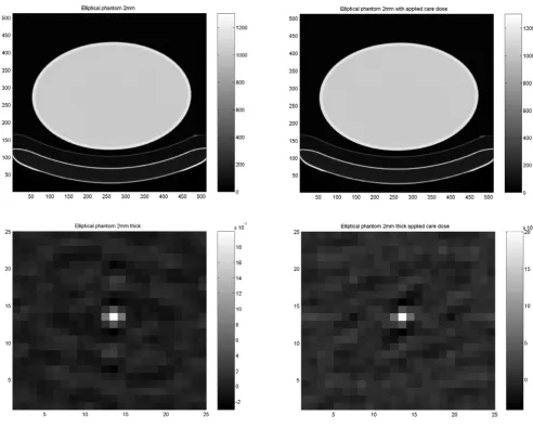 Figure 4Results of the cylindrical Torso phantom in CT studyResults of the cylindrical Torso phantom in CT study