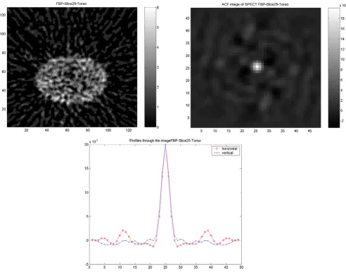 Figure 6Results of SPECT study on elliptical Torso phantomResults of SPECT study on elliptical Torso phantom